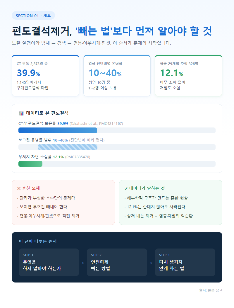 편도결석제거 개요