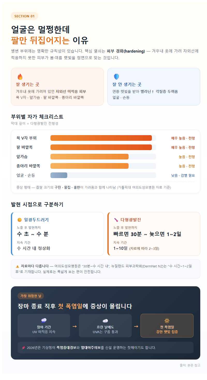 1. 얼굴은 멀쩡한데 팔만 뒤집어지는 이유