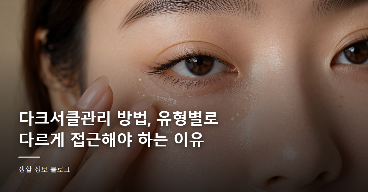 다크서클관리 방법, 유형별로 다르게 접근해야 하는 이유