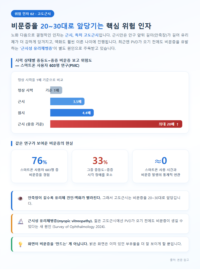 2. 고도근시 — 비문증을 20~30대로 앞당기는 핵심 위험 인자
