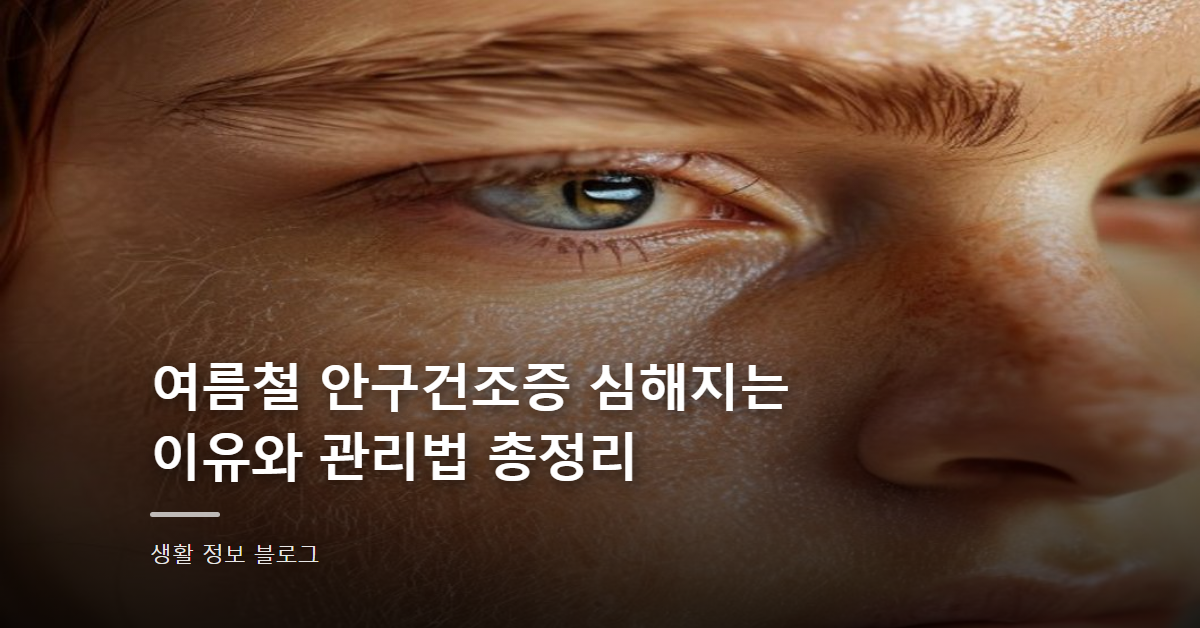 여름철 안구건조증 심해지는 이유와 관리법 총정리