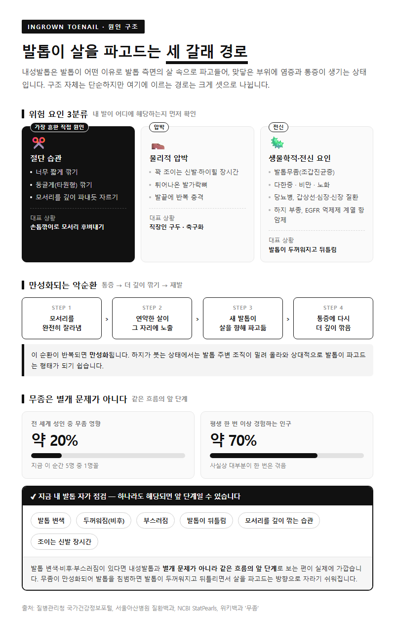 1. 발톱이 살을 파고드는 구조와 위험 요인