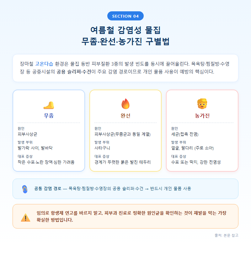 4. 여름철 감염성 물집 — 무좀·완선·농가진 구별법