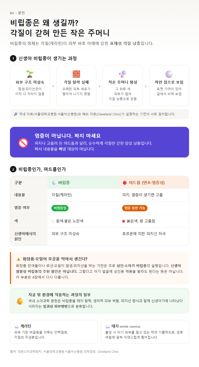 2. 왜 생기는가 — 각질이 갇혀 만든 작은 주머니