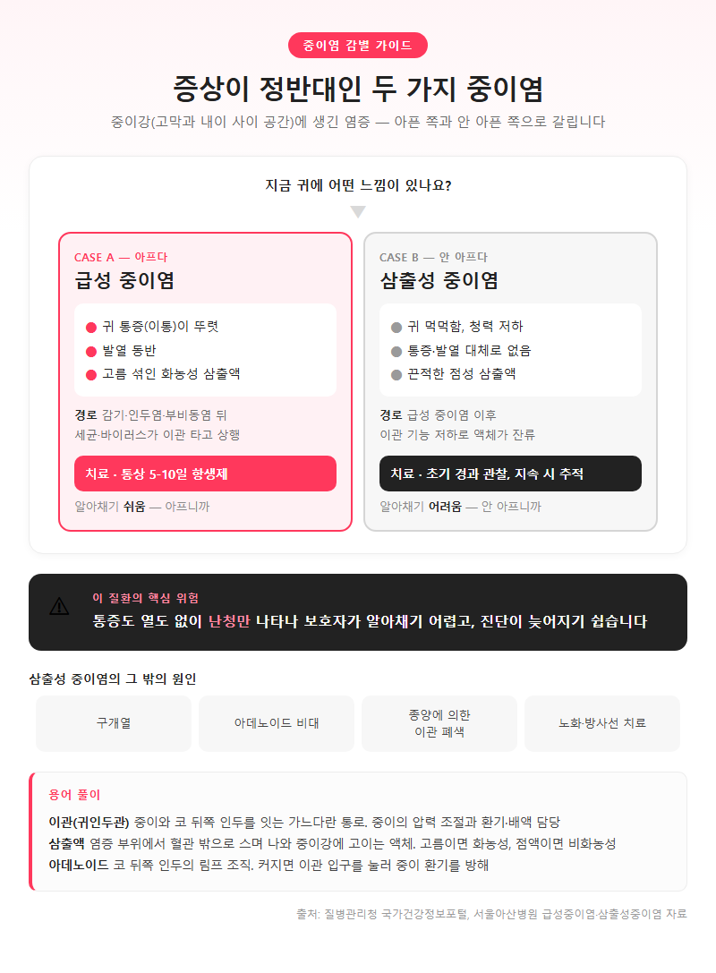 1. 급성과 삼출성, 증상이 정반대인 두 가지 중이염
