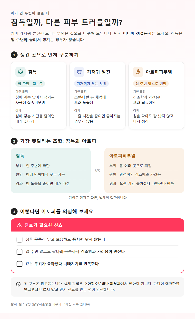 2. 침독과 헷갈리는 피부 트러블 구분법