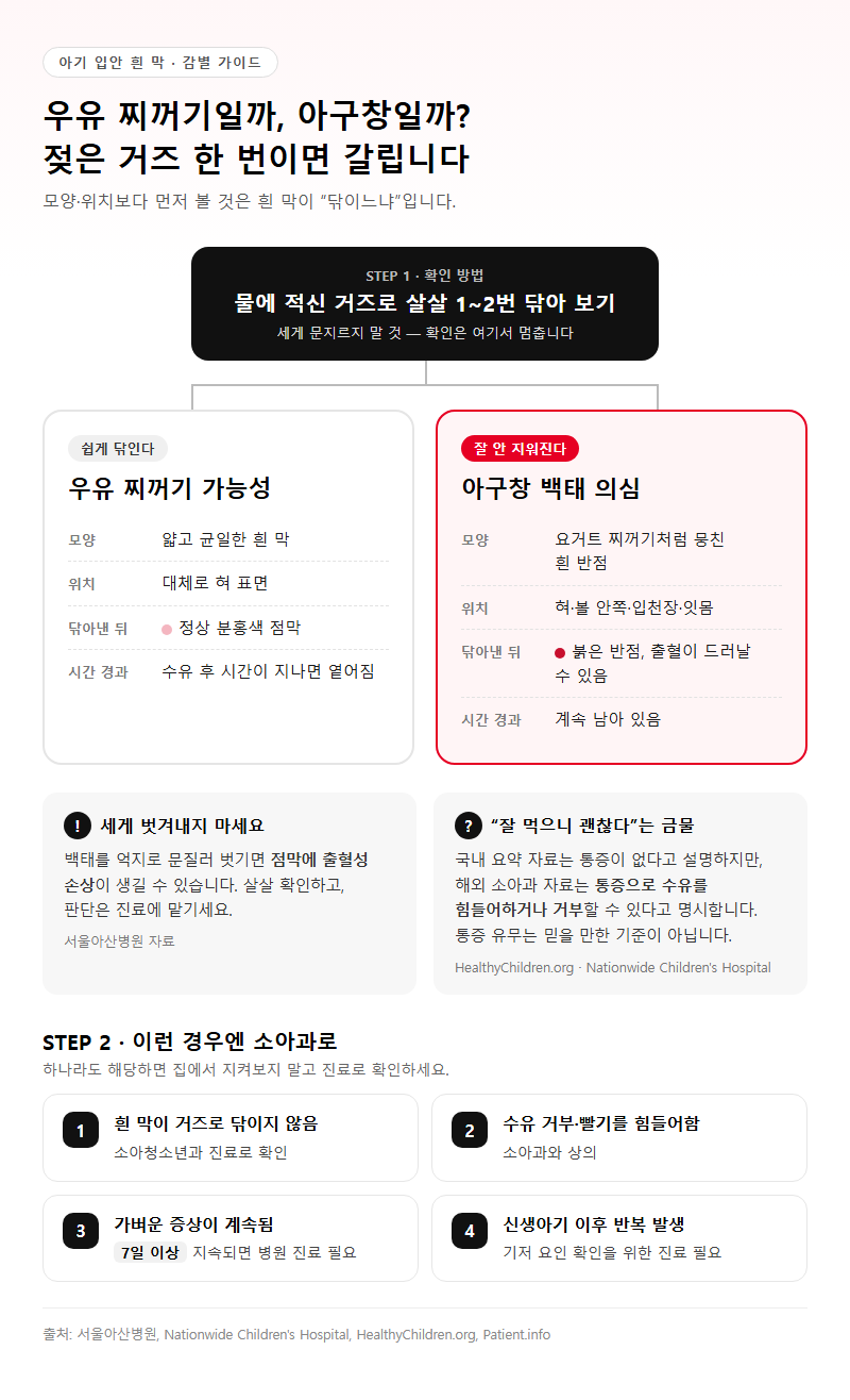 1. 우유 찌꺼기와 아구창 백태, 거즈로 구별하는 기준