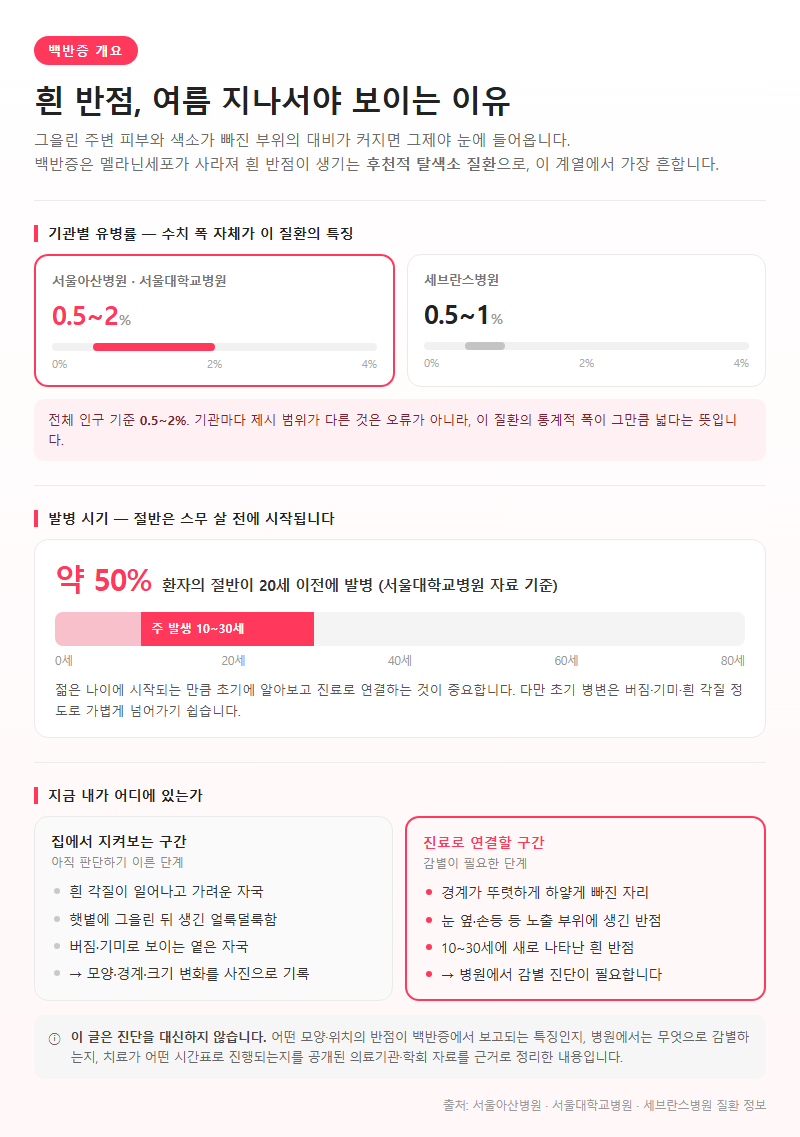 백반증 개요