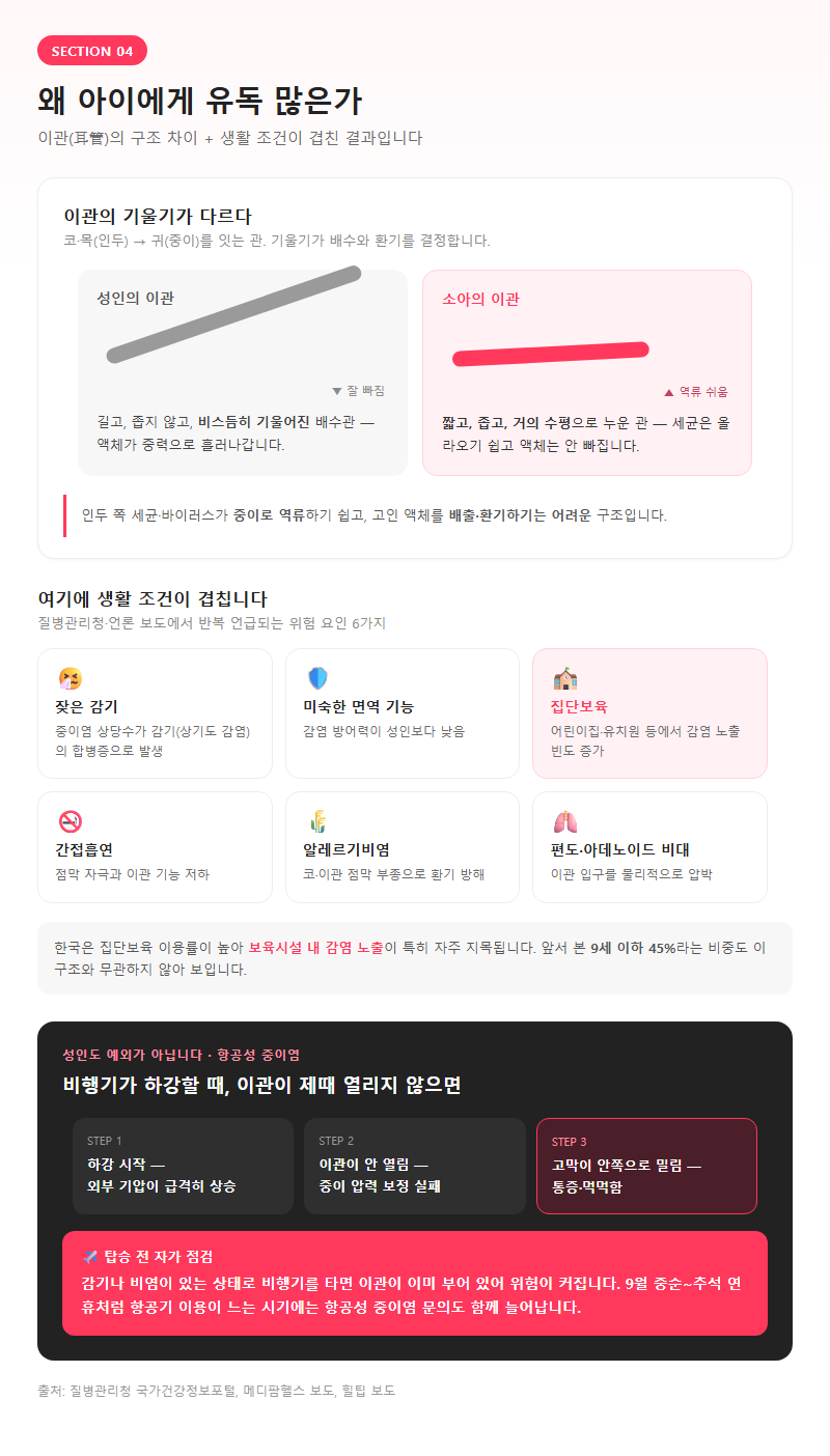 4. 왜 아이에게 유독 많은가 — 이관 구조와 위험 요인