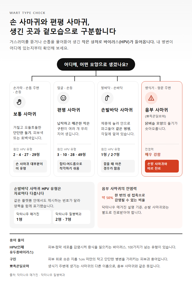 1. 손 사마귀와 편평 사마귀, 부위별 증상은 이렇게 다릅니다