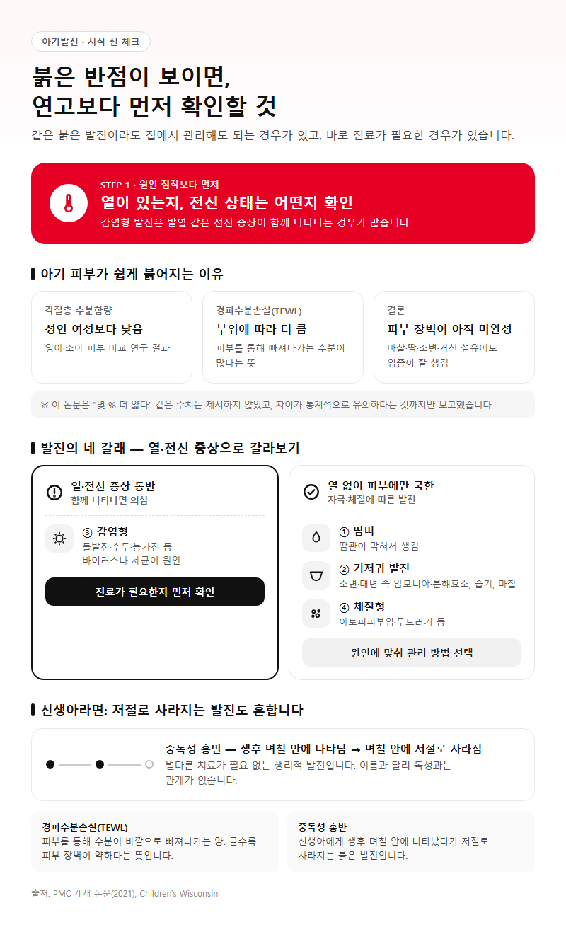 아기발진 시작 전 확인할 것