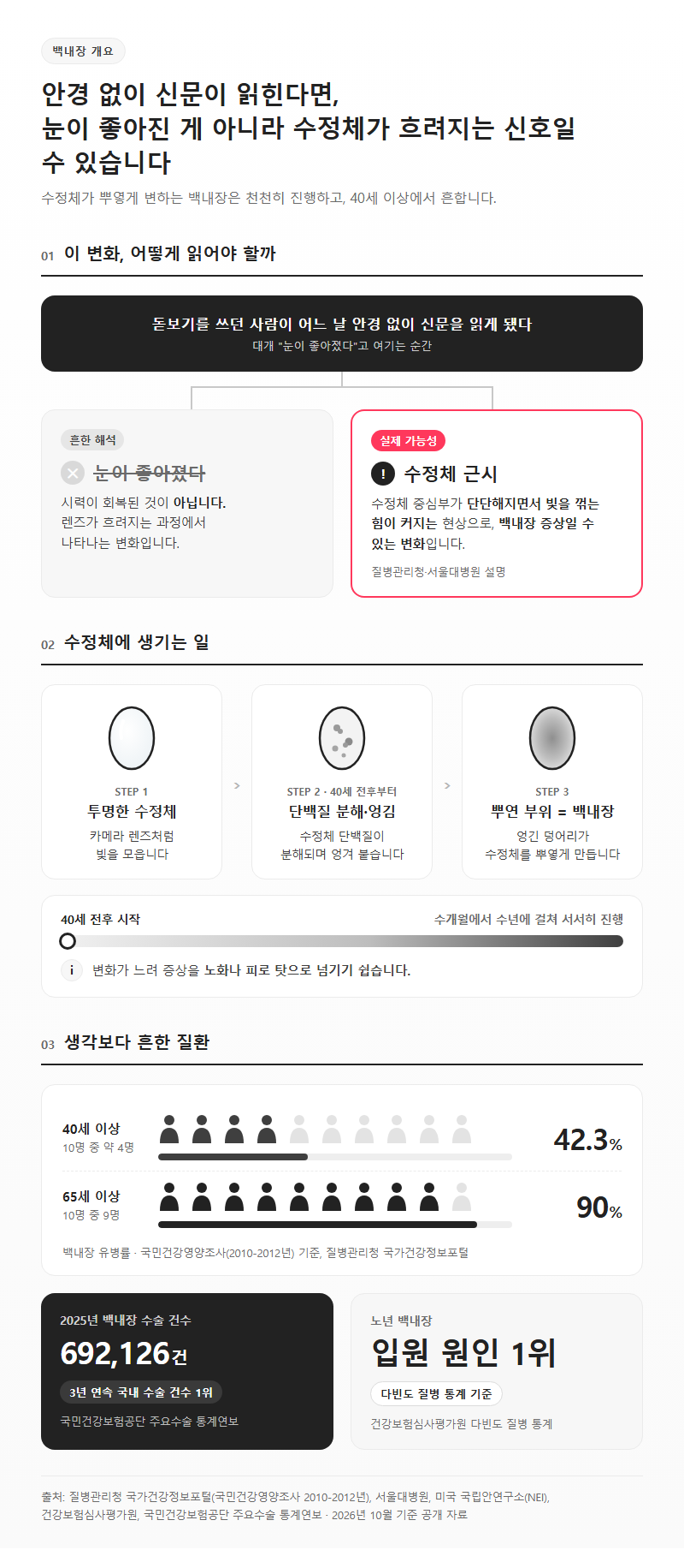 백내장 개요