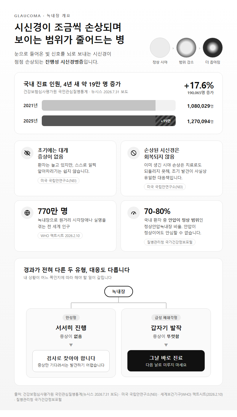 녹내장 개요