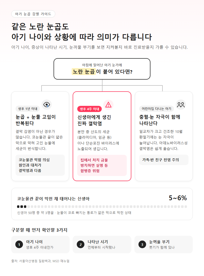 아기결막염 개요
