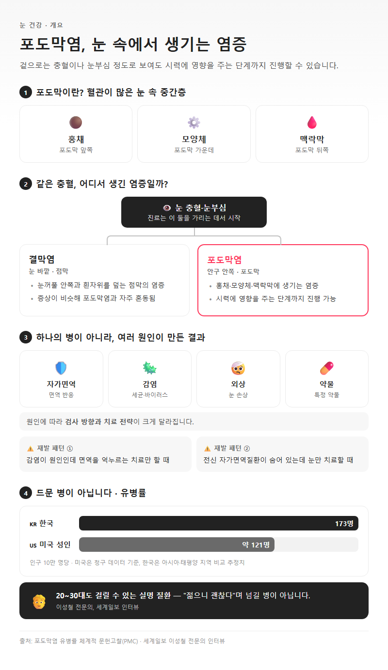 포도막염 개요