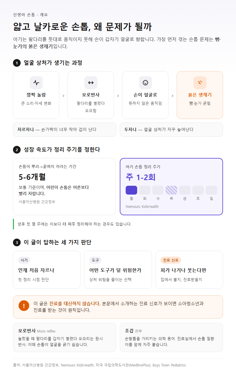 신생아손톱 개요